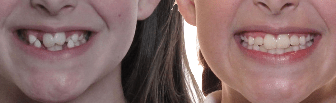 Case Study 51 – Crowding