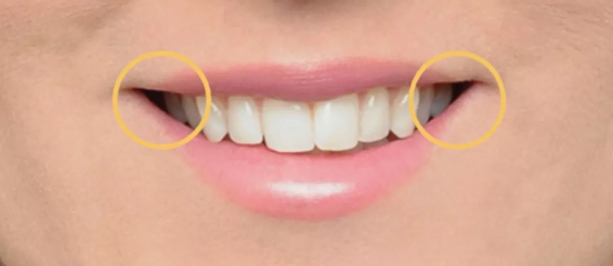 Patient's smile before treatment