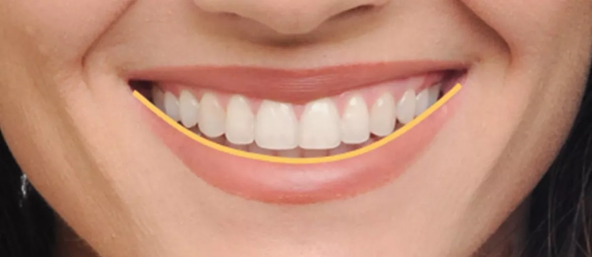 Patient's smile after treatment