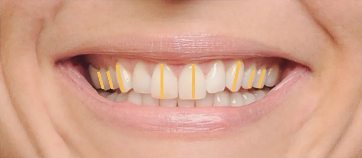 Patient's smile before treatment