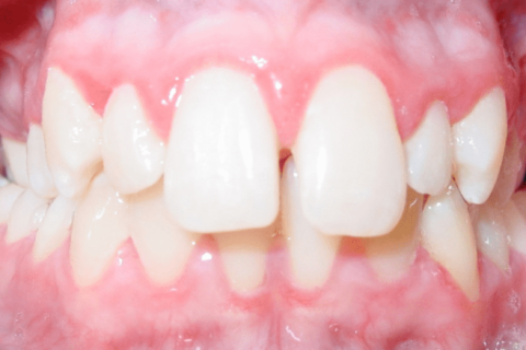 The image of teeth example